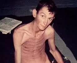 Foto-soldado-desnutrido